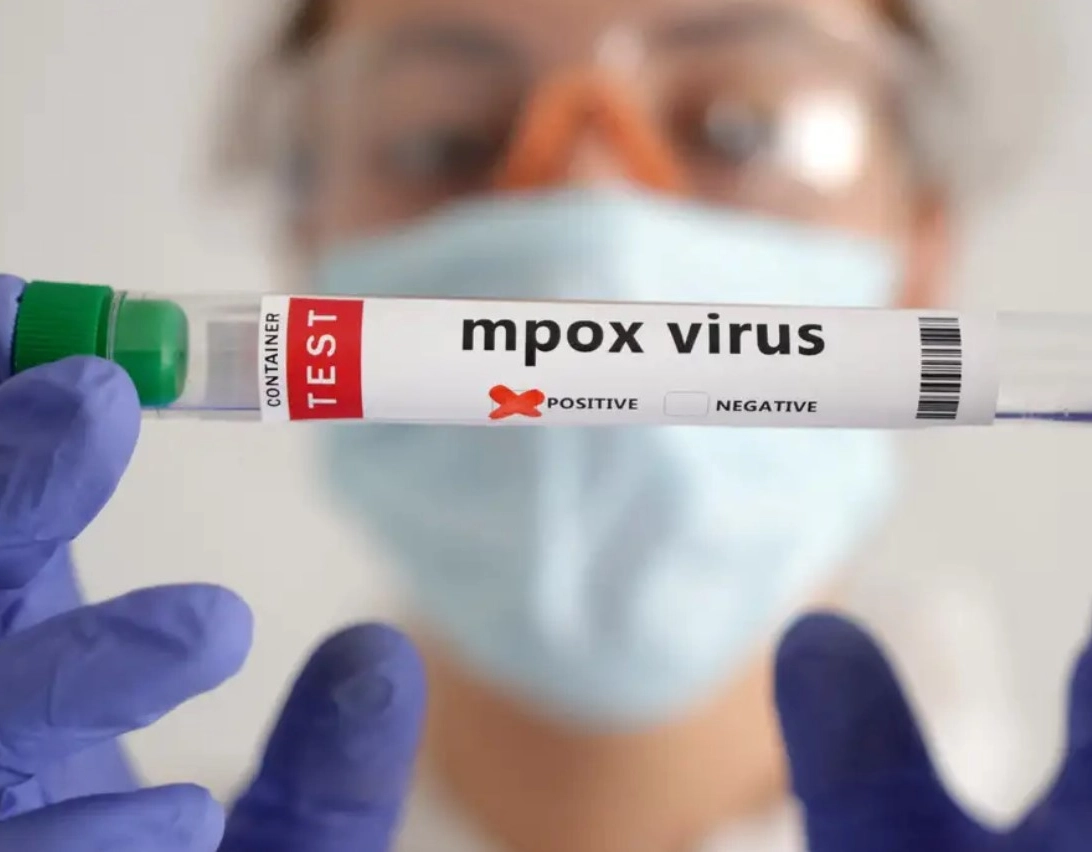 OMS estima custo de US$ 135 milhões em 6 meses para conter mpox