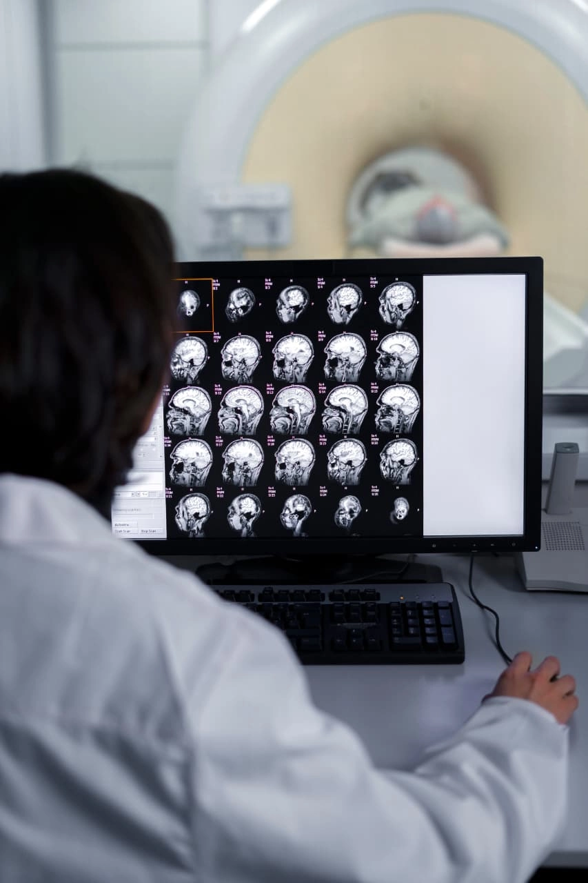 Brasil registra uma morte por AVC a cada seis minutos e meio, aponta levantamento
