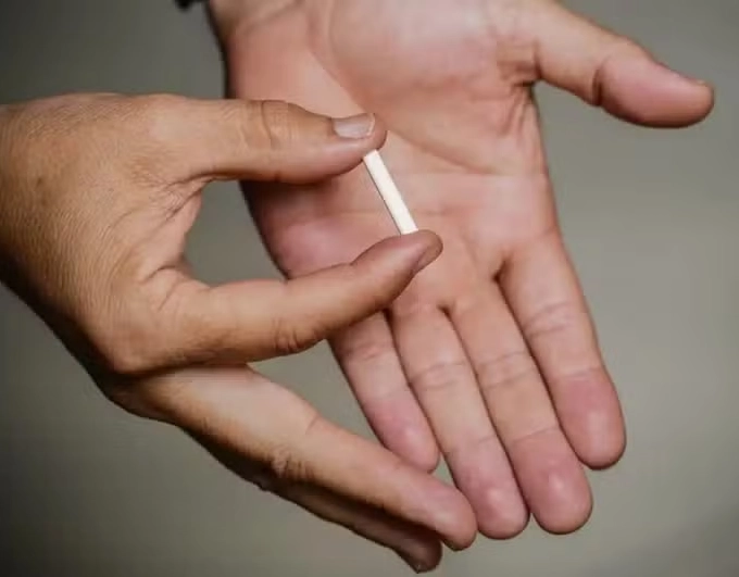 SUS vai oferecer implante contraceptivo gratuito para mais de 500 mil mulheres em 2025