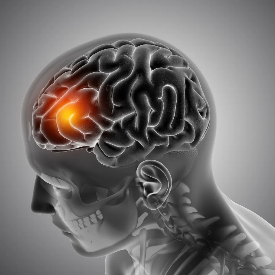 Brasil registra uma morte por AVC a cada seis minutos e meio, aponta levantamento