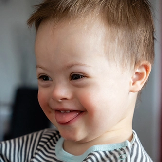 Lei obriga hospitais públicos da Bahia a comunicar casos de síndrome de Down ao nascer