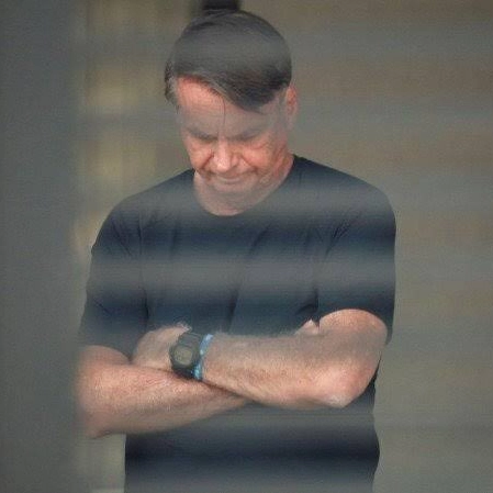 PF diz ao STF que Bolsonaro precisa passar por cirurgia com urgência