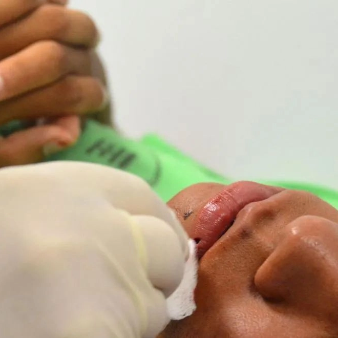 Serviço de bucomaxilofacial é reforçado para garantir atendimento rápido aos foliões