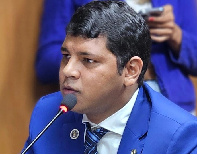 Deputado Diego Castro é internado com quadro de embolia pulmonar
