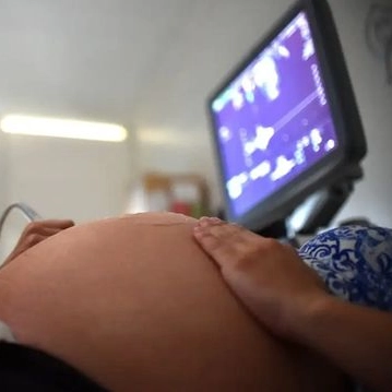 Brasil atinge menor taxa de fecundidade já registrada: 1,55 filho por mulher