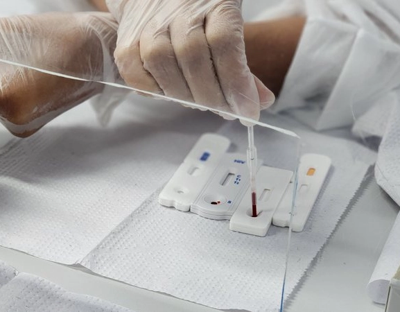 Sesab nega surto de HIV/Aids entre jovens na Bahia