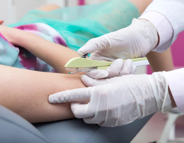 Implante contraceptivo de longa duração é oferecido em Salvador gratuitamente