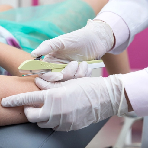 Implante contraceptivo de longa duração é oferecido em Salvador gratuitamente