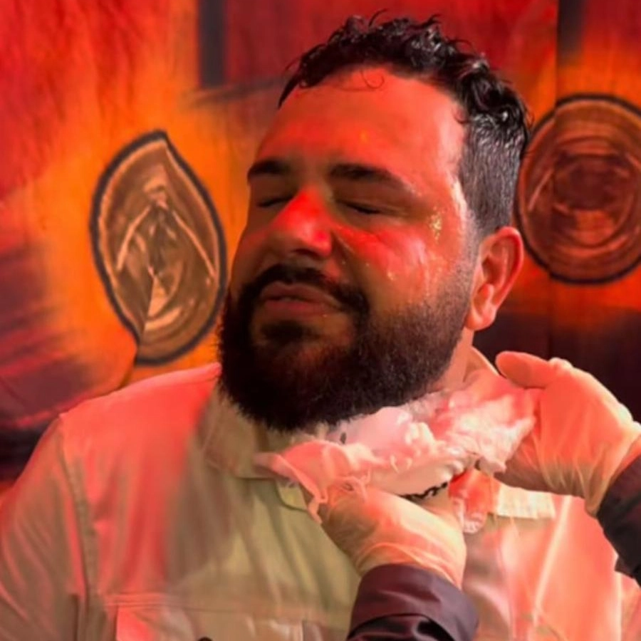 Assista: cantor sertanejo sofre queimadura no rosto durante show