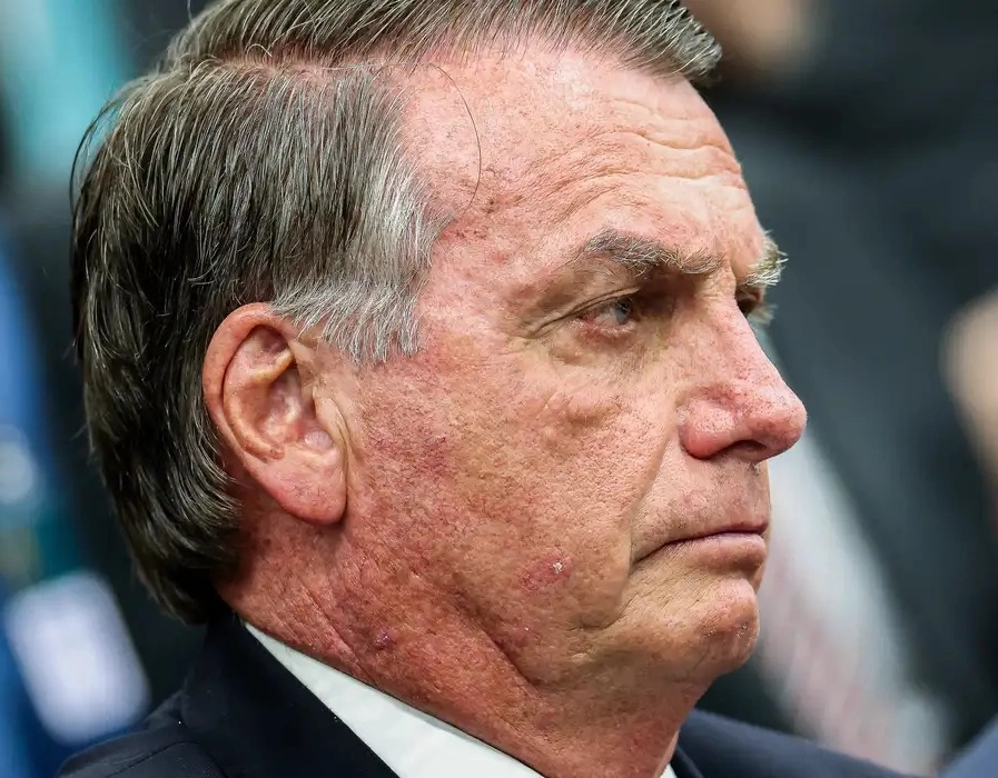 Defesa pede ao STF autorização para cirurgia de Bolsonaro